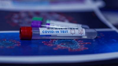 За сутки в Казахстане выявили 72 зараженных коронавирусом