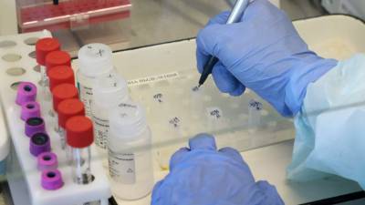 В МЧС рекомендовали ограничить просмотр новостей о коронавирусе