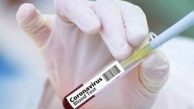 78 человек заразились коронавирусом в Казахстане за сутки