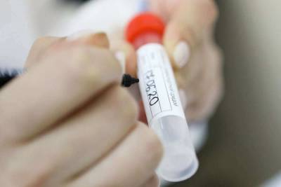 Минздрав опубликовал приказ о тестировании пациентов на грипп и коронавирус