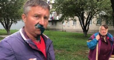 Четверо радикалов напали на оппозиционного депутата в Житомире