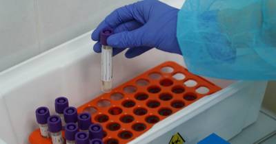Центр Гамалеи подтвердил случай повторного заражения коронавирусом