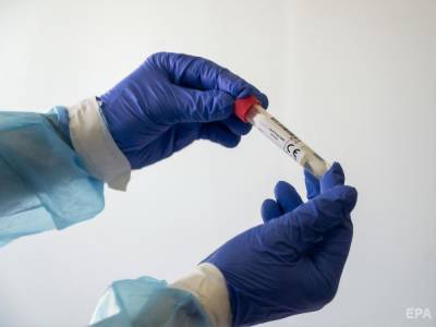 В Украине планируют проводить новый вид тестирования на коронавирус
