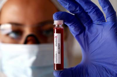 Медики зафиксировали меньше 3 000 случаев коронавируса за сутки: статистика на 20 сентября