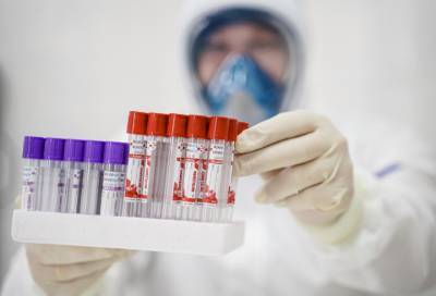 За последние сутки в России выявили 6148 новых случаев коронавируса