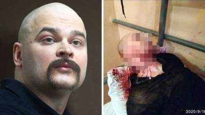 Адвокат: Травмы на теле «Тесака» Марцинкевича нанесены кем-то другим
