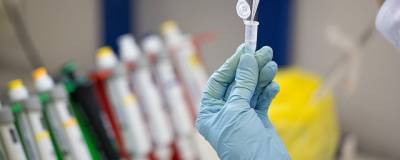 ВОЗ: Россия успешно завершит испытания вакцины от COVID-19