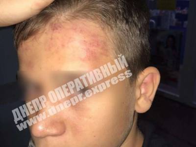 В Никополе ромы у школы избили 12-летнего мальчика