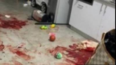 Кровавая драма в Мицпе-Рамоне: "Муж выбил ей все зубы и изрезал лицо"