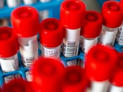 В Арцахе зарегистрировано 12 новых случаев заражения коронавирусной инфекцией