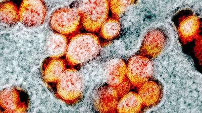 Ученый узнал об иммунитете к COVID-19 у переболевших лихорадкой Денге