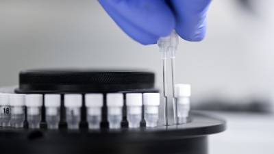 Число случаев коронавируса в Грузии достигло 3913