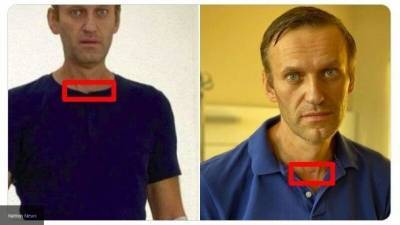 А у вас голова отклеилась! – свежие фото Навального имеют признаки монтажа