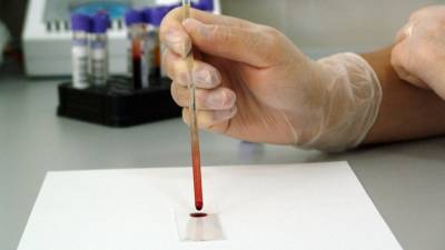 Стандартный анализ крови определяет риск смерти от COVID-19