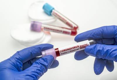 В России за сутки выявили 7 212 новых случаев коронавируса