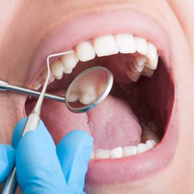 Стоматологи объяснили, какие проблемы могут возникнуть, если вовремя не лечить зубы