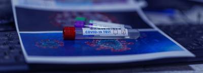 В России за сутки зафиксировано более 7,5 тысячи случаев заражения коронавирусом