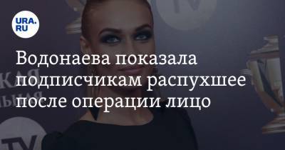 Водонаева показала подписчикам распухшее после операции лицо. ВИДЕО
