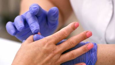 Как узнать онкологию по состоянию ногтей – совет врача