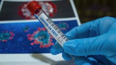 В области не хватает специалистов для тестирования на коронавирус