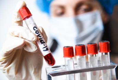 В Ленобласти за сутки выявлено 63 новых случая коронавируса