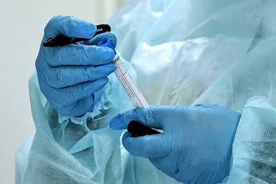 Всего один житель Чувашии вылечился от коронавируса за сутки, заболели 28