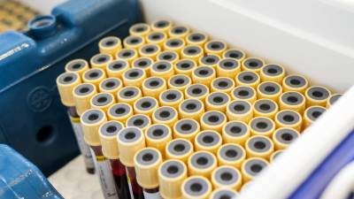 Число случаев коронавируса в Бразилии достигло 4 745 464