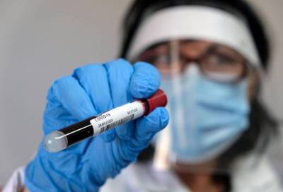 Еще 8232 новых случаев коронавируса зафиксировано в России за сутки