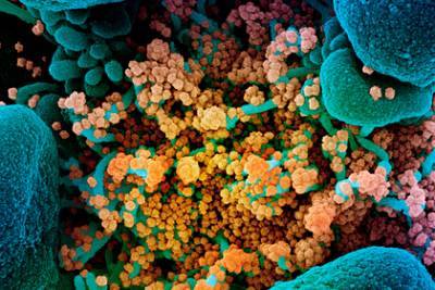 Учеными США раскрыта загадка смертельных осложнений от коронавируса