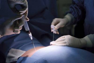 В Охматдете провели трансплантацию костного мозга: операцию оплатил Минздрав