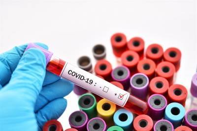 122 заболели, 6 умерли: данные по коронавирусу в Ульяновской области за сутки