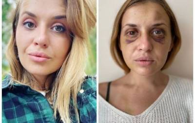 Нападение на Анастасию Луговую в поезде: девушка раскрыла новые подробности ужасного события