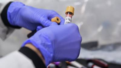 Более 37,8 млн тестов на коронавирус проведено в России