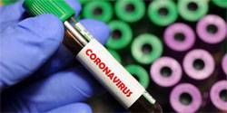 За сутки 49 жителей Орловской области заболели коронавирусом