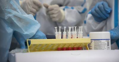 В каких муниципалитетах региона выявили новые случаи коронавируса (список)
