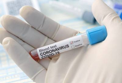 Новые 33 случая коронавируса выявили в 11 районах Ленобласти