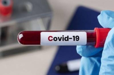В Молдавии 534 новых заражений Covid-19, вакцину ждут из России и Китая