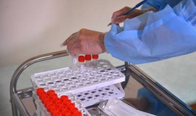 В Латвии продолжают фиксировать новые случаи заражения коронавирусом