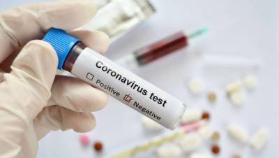 В Казахстане за сутки выявили 139 больных коронавирусной пневмонией
