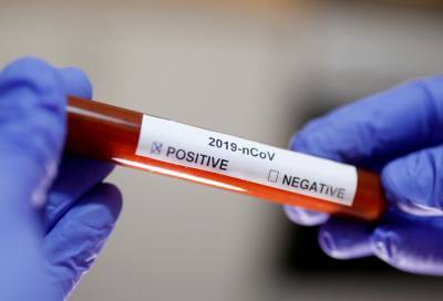 В России выявили 5099 новых случаев коронавируса