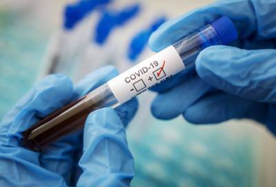 Новые 37 случаев коронавируса выявили в 11 районах Ленобласти