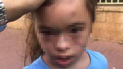9-летнюю девочку с синдромом Дауна жестоко избили в школе Бней-Брака