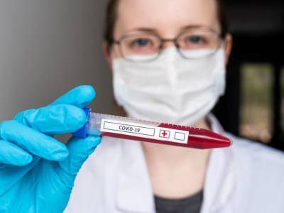 В Украине за сутки обнаружили более 2,5 тысяч случаев заражения коронавирусом