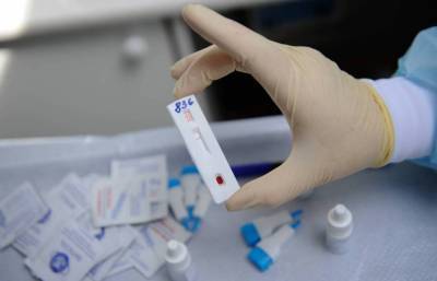 Из российских аптек изымают экспресс-тесты на ВИЧ