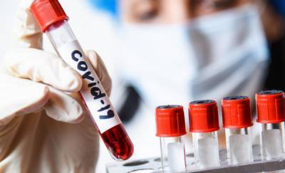 В Тюменской области провели больше миллиона тестирований на коронавирус
