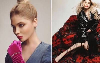 "Я носила парики": Алена Шишкова впервые откровенно рассказала о проблемах с волосами