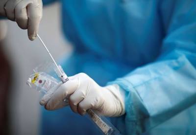 В Украине 5116 новых случаев коронавируса и втрое больше выздоровевших