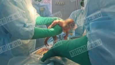 Врачи спасли беременную иркутянку со стопроцентным поражением легких — видео
