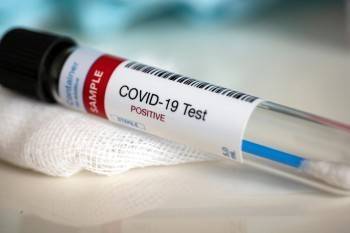 У 90 млн человек в мире подтвержден диагноз «коронавирус»