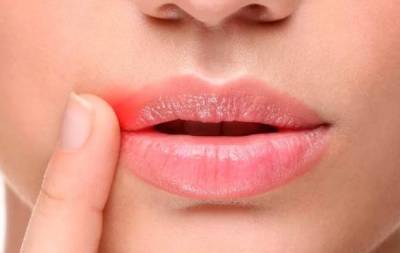 Как быстро вылечить заеды в уголках рта: эффективные способы